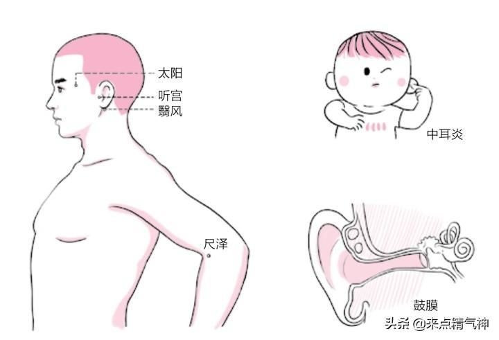 盆腔有积液艾灸后三个月未见消退，深度探究与治疗建议